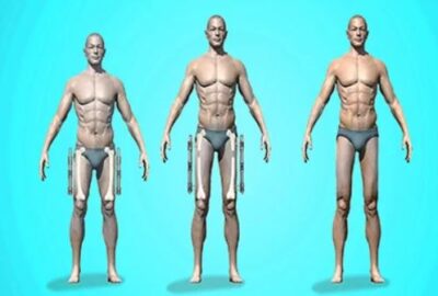 جراحی زیبایی اندام و باسن