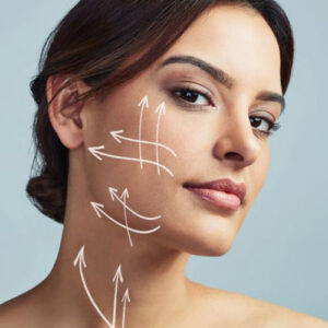 لیفت شقیقه با آندوسکوپ