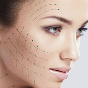 لیفت شقیقه با آندوسکوپ