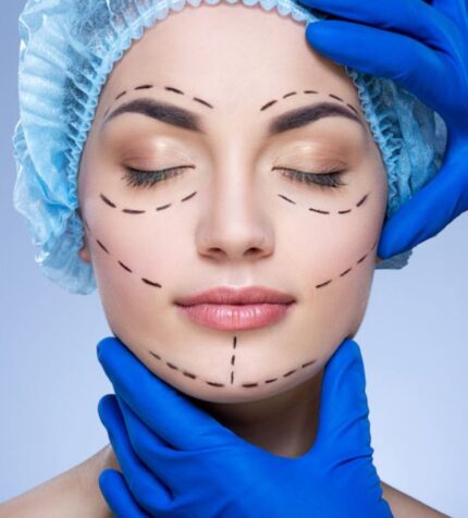 لیفت گونه با آندوسکوپ