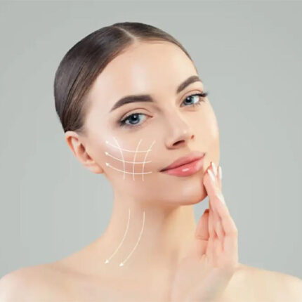 جراحی کوچک کردن استخوان گونه