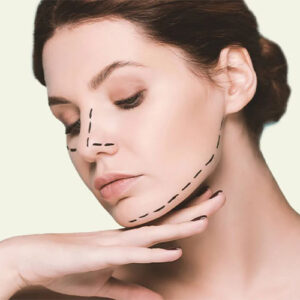 جراحی کوچک کردن استخوان گونه