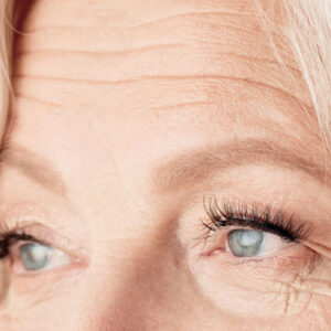 لیفت پیشانی