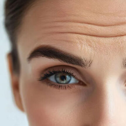 لیفت پیشانی