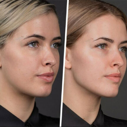 کانتورینگ صورت