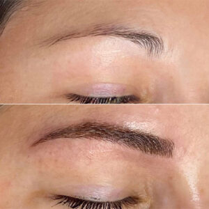 زیبایی و کاشت