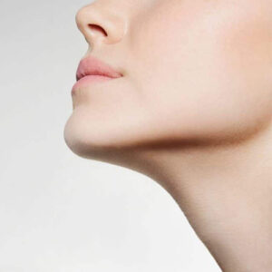 طراحی زاویه فک